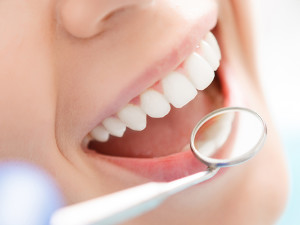 Cos’è e come si cura la parodontite